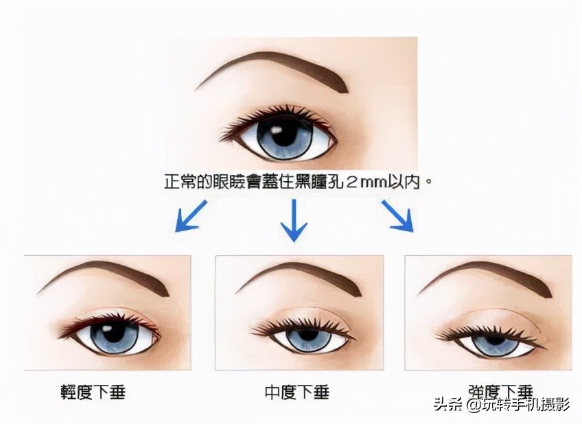 如何让眼睛拍照有神,拍照眼睛无神怎么改善