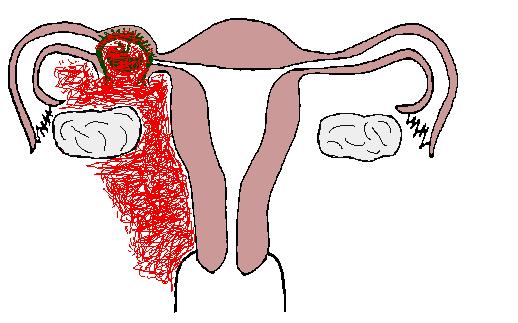 孕妇做介入对胎儿有什么影响,怀孕了到医院路过介入科有影响吗