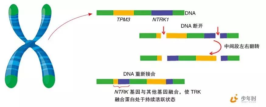 费城染色体p210阳性,费城染色体的由来