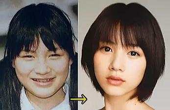 日本整容惊人案例,日本整容是不是最先进