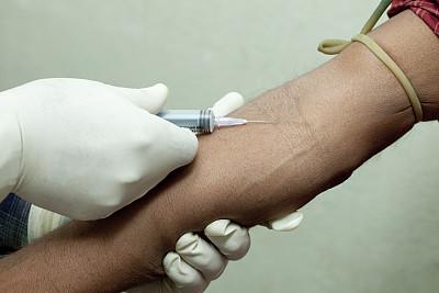 全球有多少人因为打耳洞感染艾滋,打耳洞感染艾滋病案例有多少