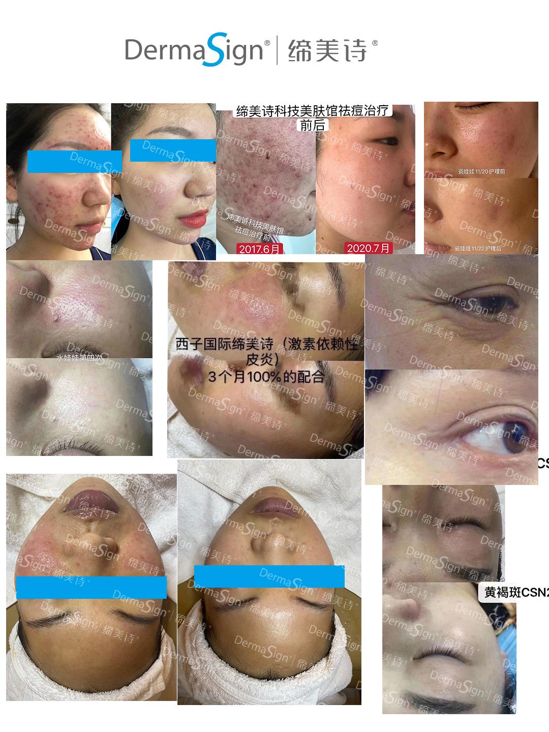 缔美诗秋冬专业组合高能抗敏抗烂脸，德国屏障科研51年