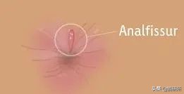 猫咪会长毛囊炎吗,猫咪会长老年斑吗