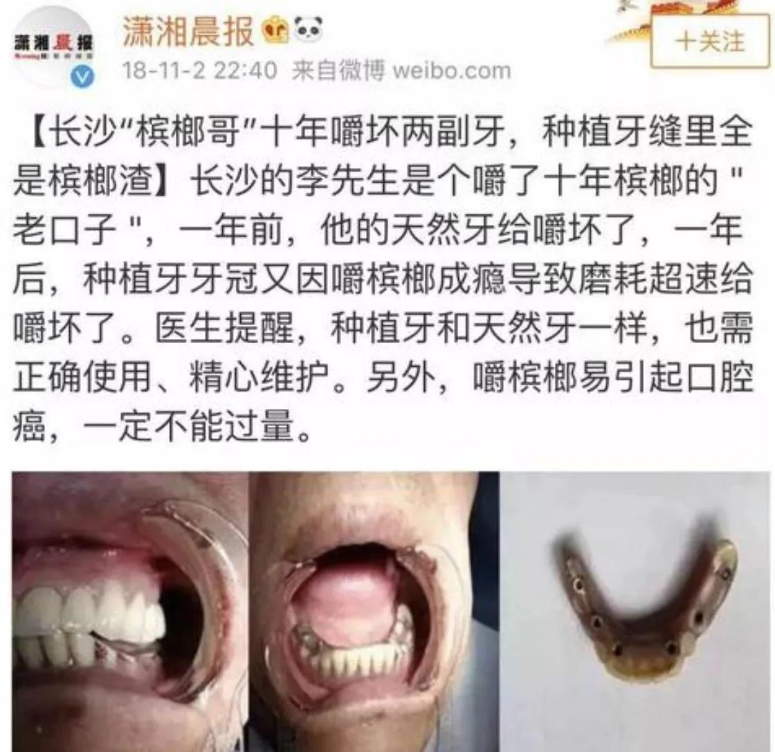 盘点嚼槟榔是怎么上瘾的,嚼槟榔十几年戒槟榔