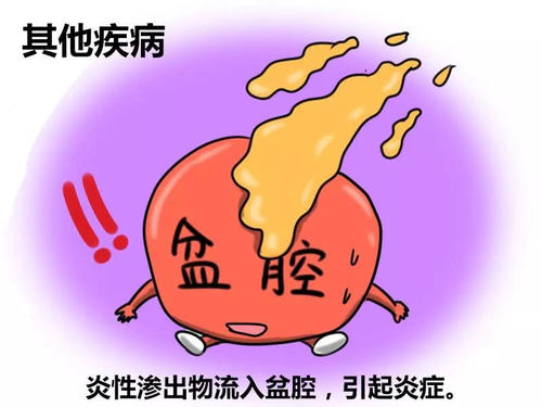 生理性出血怎么办,女生发生性出血是什么原因