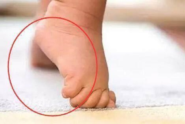 宝宝过早学站立腿不直,婴儿几个月练站不影响腿部发育