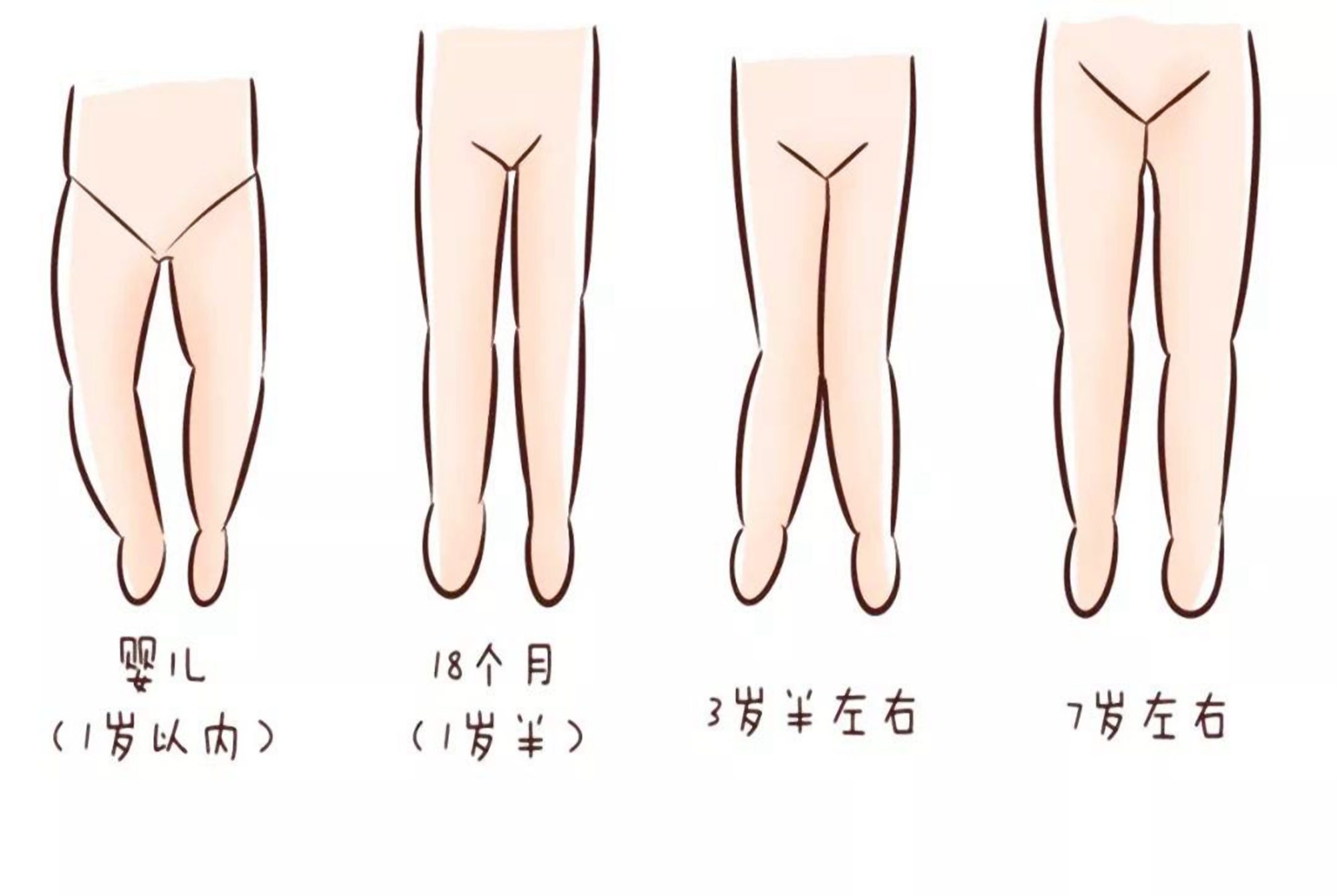 宝宝腿部发育不良,孩子腿部发育不良怎么办