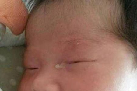 宝宝眼睛上火能用母乳擦眼睛吗,妈妈上火了宝宝吃母乳会眼泡肿吗