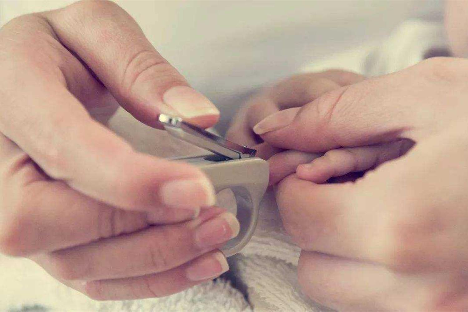 有什么好办法给婴儿剪指甲,给宝宝剪指甲如何防剪到肉