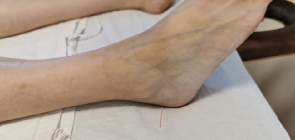 奇经八脉是哪八脉有什么作用,三焦经治疗肩周炎穴位