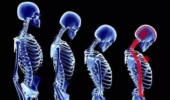 颈椎引起的头晕怎么办最有效方法,颈椎引起头晕怎么理疗