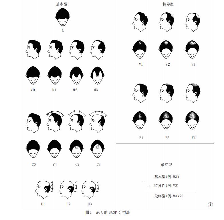 有没有治疗脱发的有效方法,脱发怎么办最有效的办法