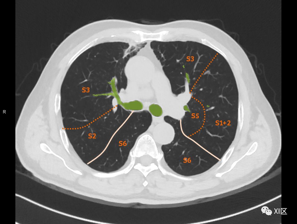 如此详细的肺部影像解剖，有点儿酷！