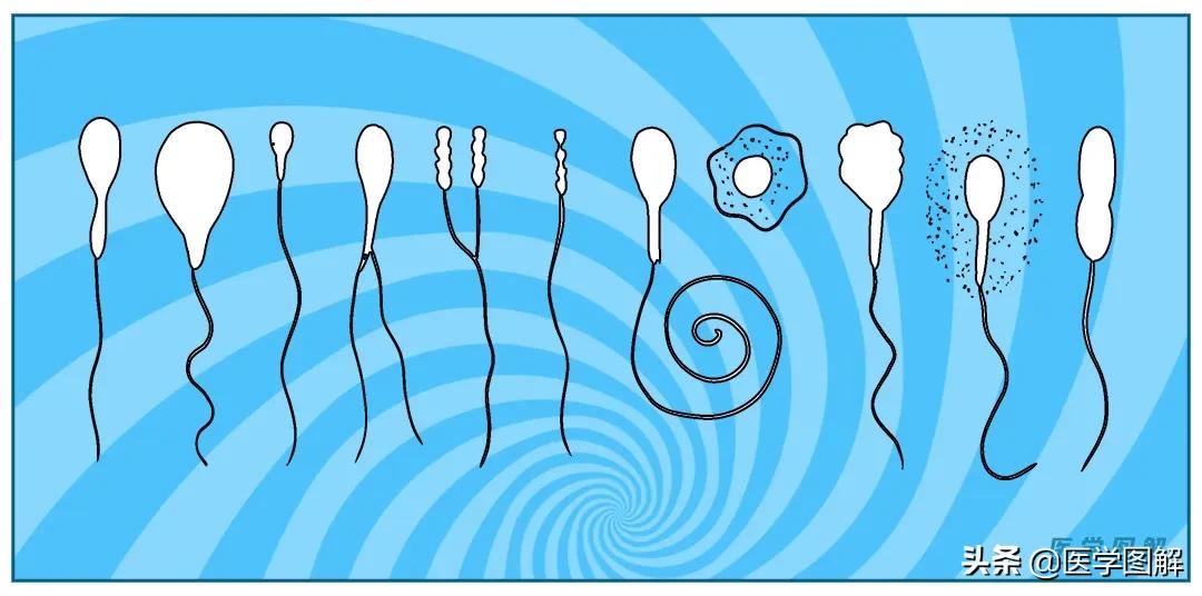 精子检测的结果怎么看懂,精子检测报告如何看懂