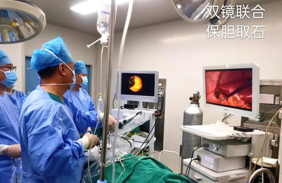 山东齐鲁医院胆囊结石保胆取石,多大的结石可以保胆取石