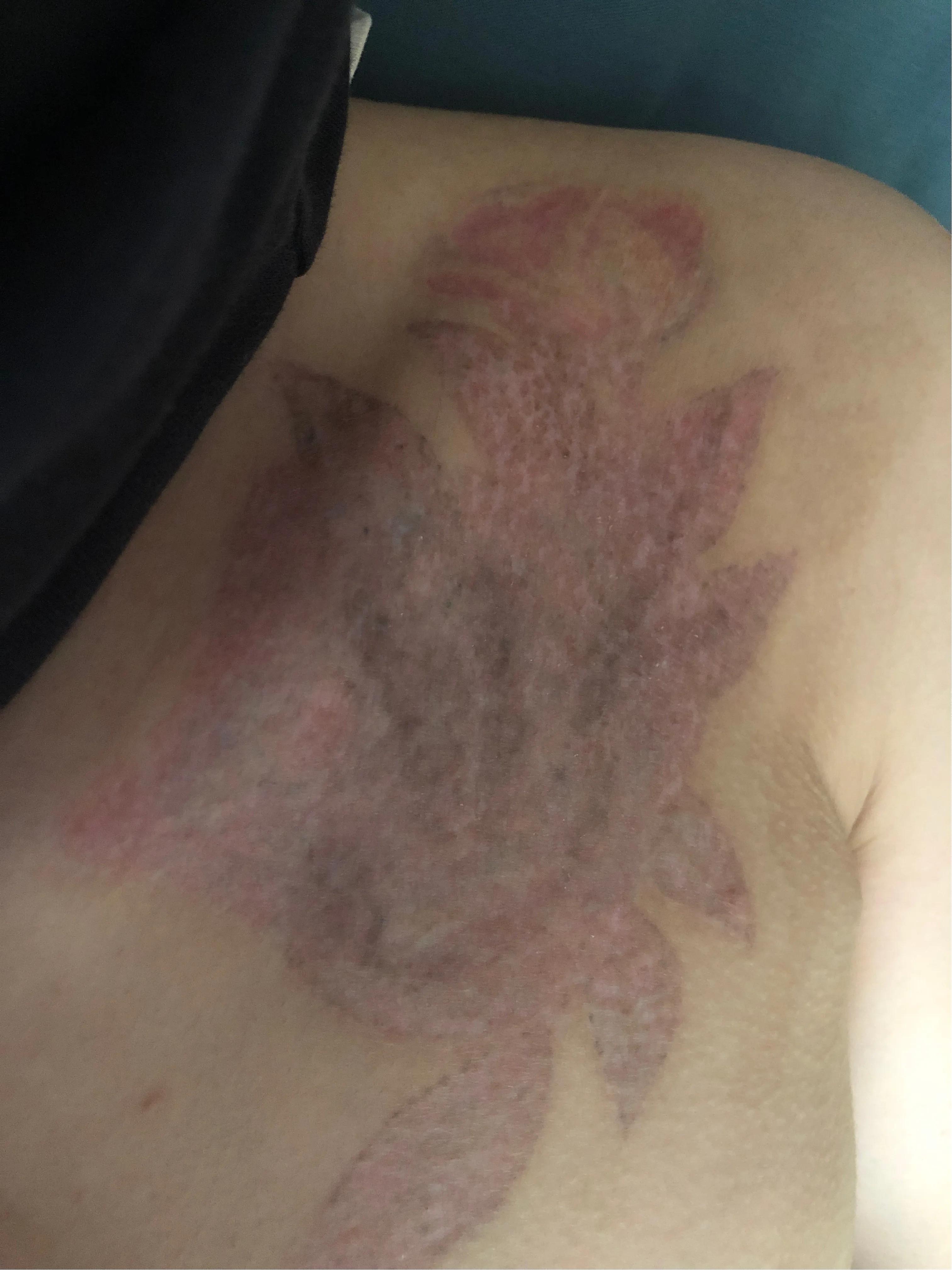 洗纹身能彻底洗掉吗豆瓣,纹身能彻底洗干净吗