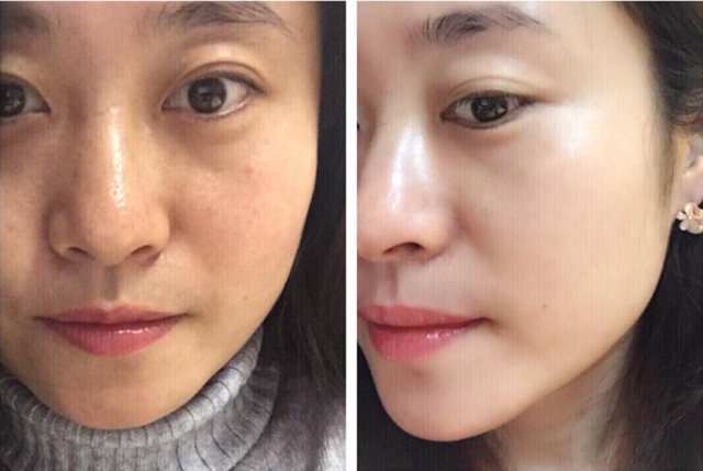 宝露斯精华液,宝露斯肌肤