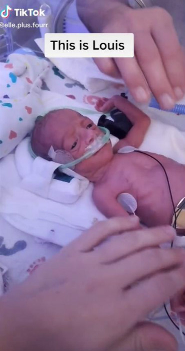 妈妈记录三胞胎一天奶量,三胞胎妈妈喂小宝宝