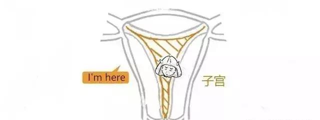 漫画详解子宫肌瘤是个啥？
