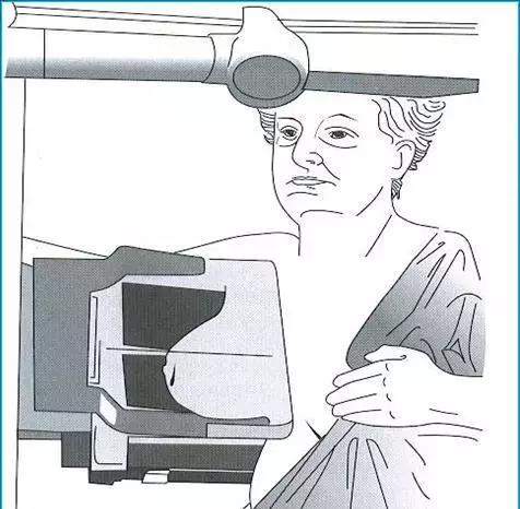 什么是乳腺纤维腺瘤？摸到乳房上有肿块，还不痛，就要小心了