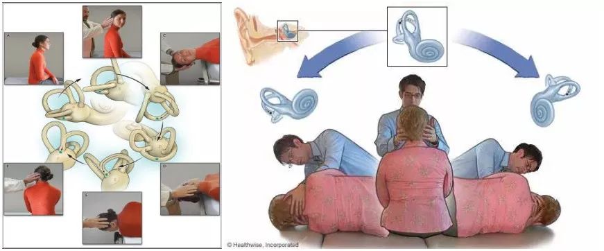 四大名药治眩晕症,哪家医院治疗眩晕症比较好