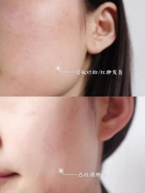 48岁袁咏仪面霜,袁咏仪和李佳琦哪个好