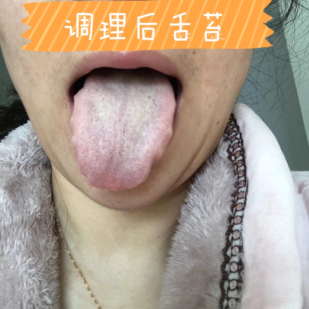 甲状腺结节子宫肌瘤卵巢囊肿调理,甲状腺乳腺结节子宫肌瘤如何调理