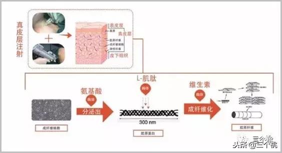 医美去颈纹全过程,去颈纹医美过程
