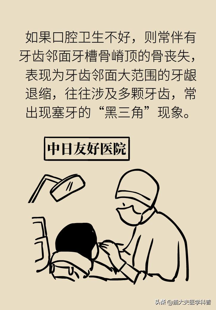 牙根露出来怎样修复不动刀,牙根暴露但没疼痛感怎么办