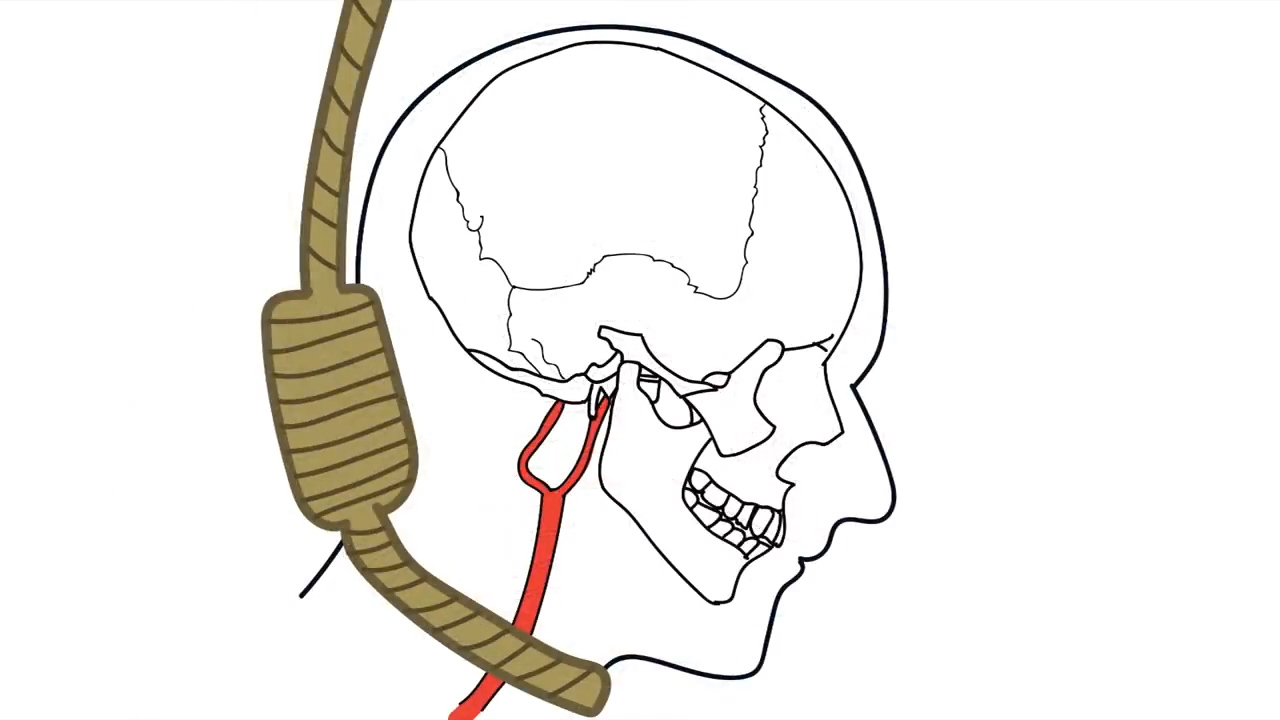 上吊反悔了能引体向上自救吗,上吊反悔了怎么自救