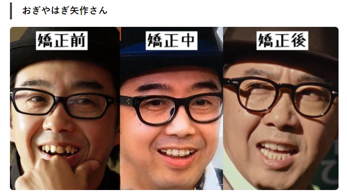 牙齿不整齐的日本女孩,日本人牙齿不齐怎么回事