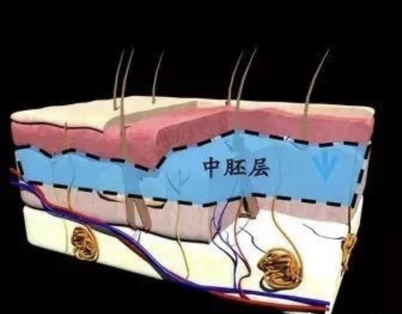 热拉提维持时间短为什么还在用,热拉提普通版有必要做吗