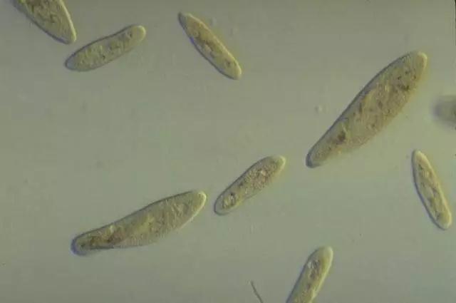 收藏!24种污水处理微生物菌相及指导意义,环保人必看(多图)