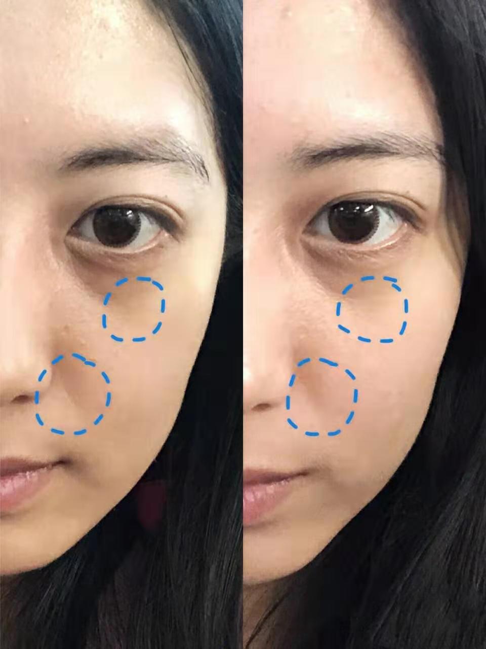 卸妆不彻底肤色不均,卸妆不彻底的后果