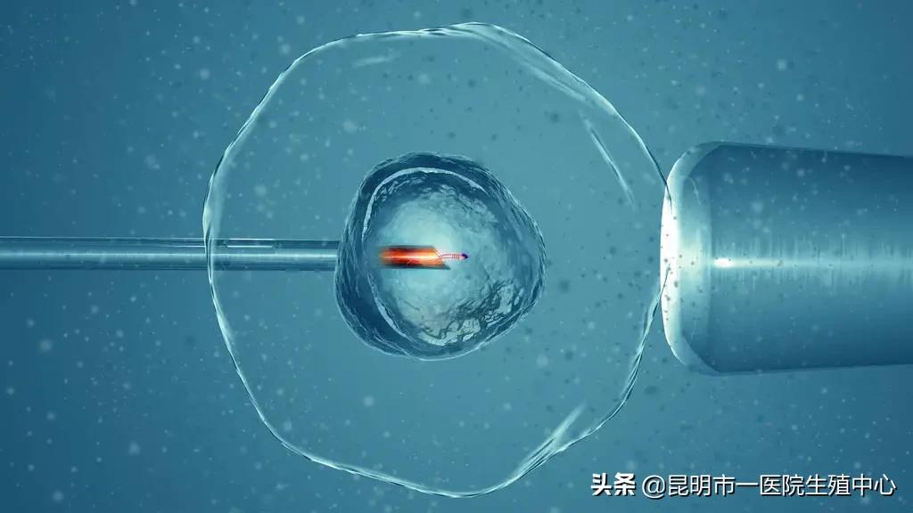 性激素六项检查什么时候做最合适,女性性激素六项检查时间