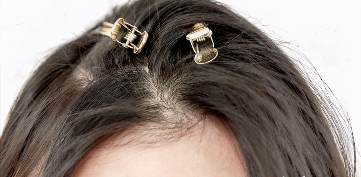 头顶很塌怎么一直蓬松,头顶尖头发塌怎么弄蓬松小妙招