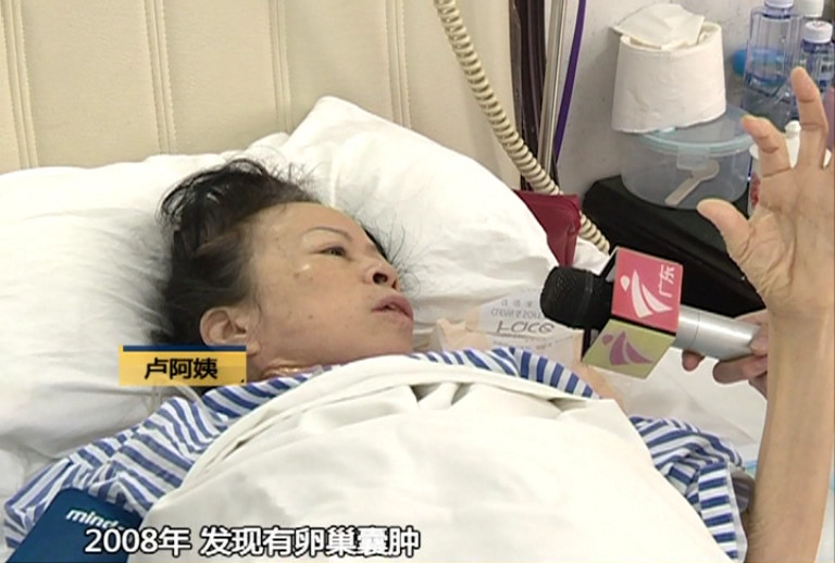 60多岁阿姨肚子大,60岁阿姨肚子忽然变大