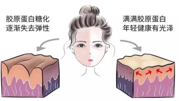 脸上细纹干纹皱纹怎么遮盖,细纹和皱纹怎么治疗