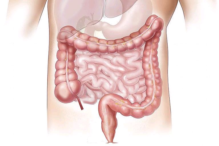 喝牛奶腹泻是乳糖不耐受吗,喝牛奶引起的腹泻是肠炎吗