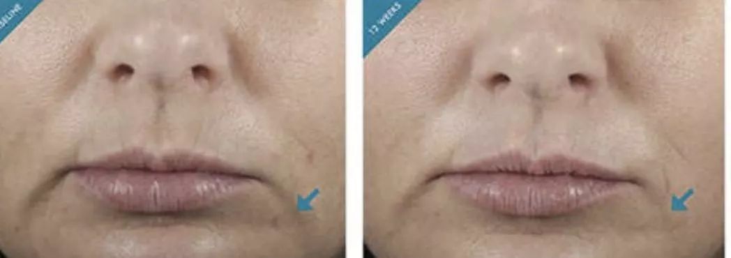 揭秘护肤成分科普,你不知道的护肤产品成分