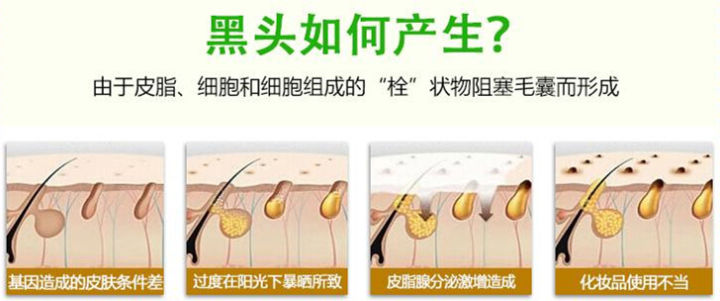 脸部黑头多毛孔粗大护理过程,鼻子黑头多毛孔粗大用药膏教程