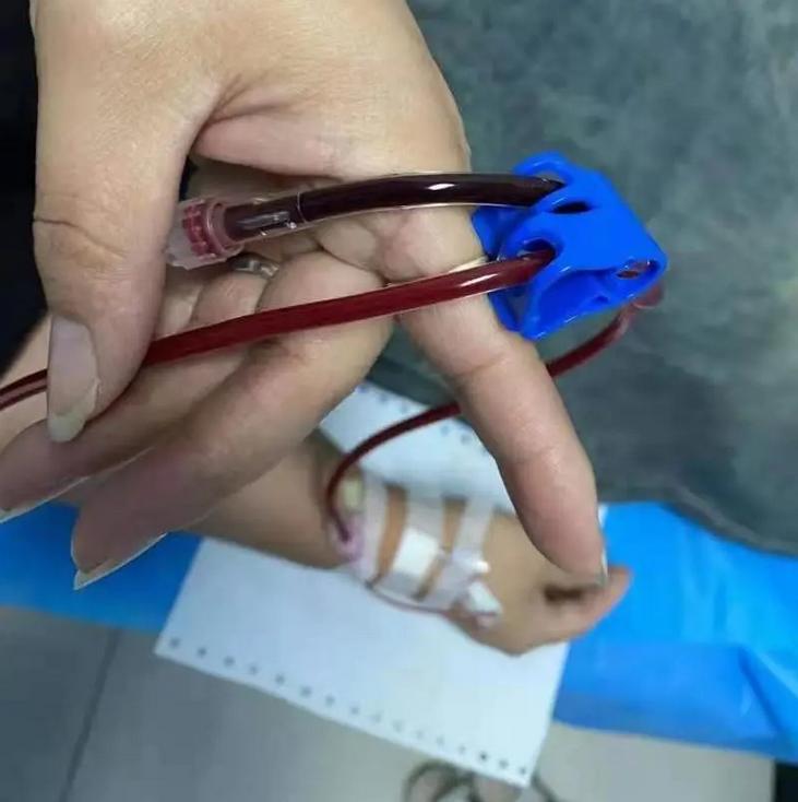 三氧大自血疗法在疼痛科的运用,天津哪个医院有自血疗法