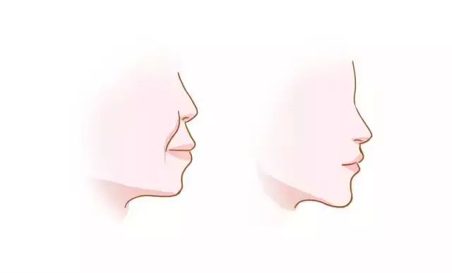 牙齿矫正全过程都在这里了,牙齿矫正一定要知道的事儿