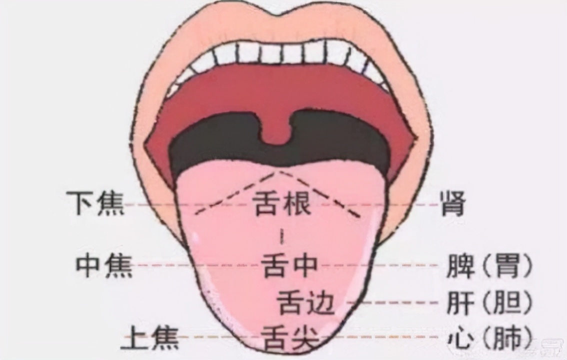 舌头痛了一般是什么病,舌头疼警惕什么病