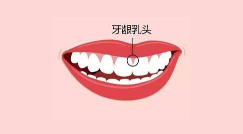 口腔护理牙缝清洁,牙缝清洁是每个牙缝都要清洁吗