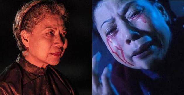 TVB*用御**“鬼婆”膝盖开刀仍隐隐作痛坚持康复训练与保持健康饮食