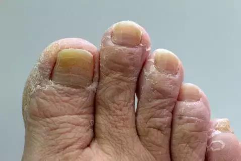 行军拉练,是时候保护好自己的“面子”了