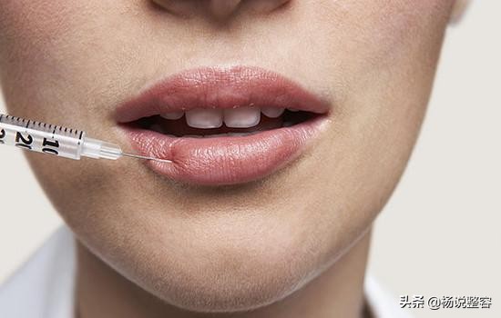 理想的注射填充剂具备的条件,填充剂都有什么