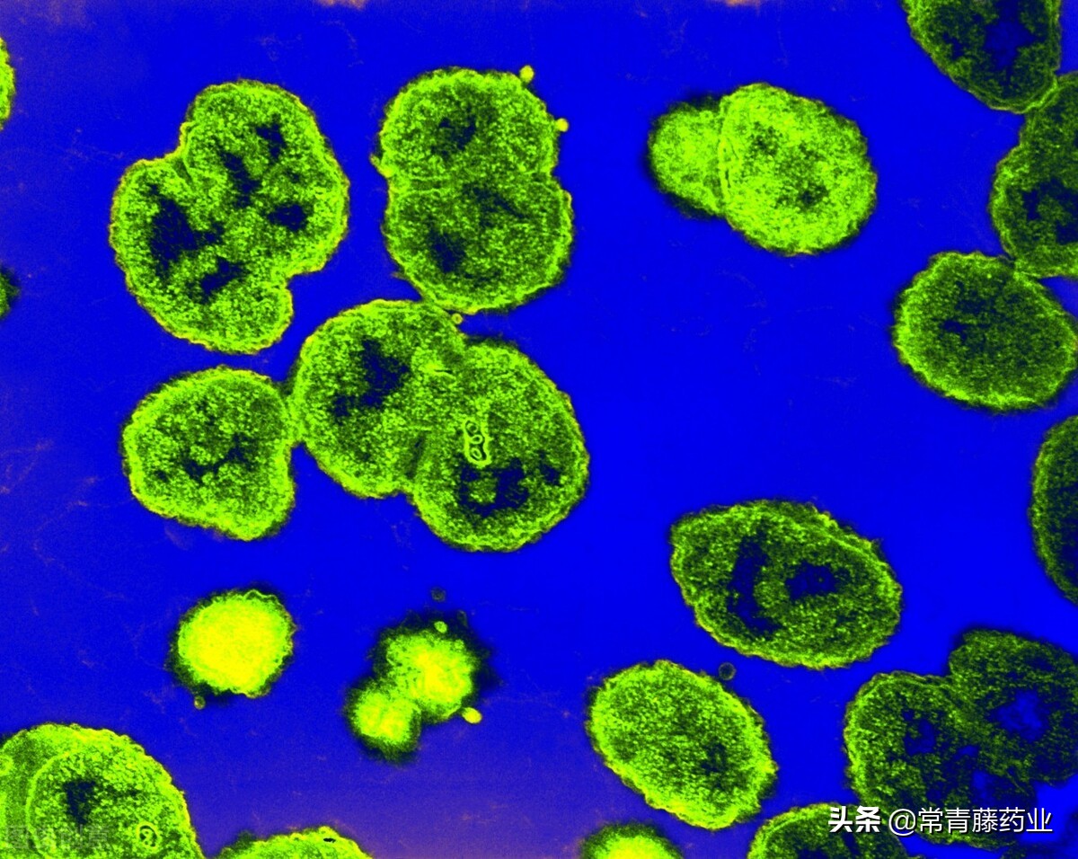 淋病检查注意什么,淋病应该去什么科室检查