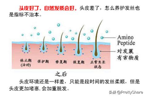 哪款洗发香波比较好,怎样挑选洗发香波